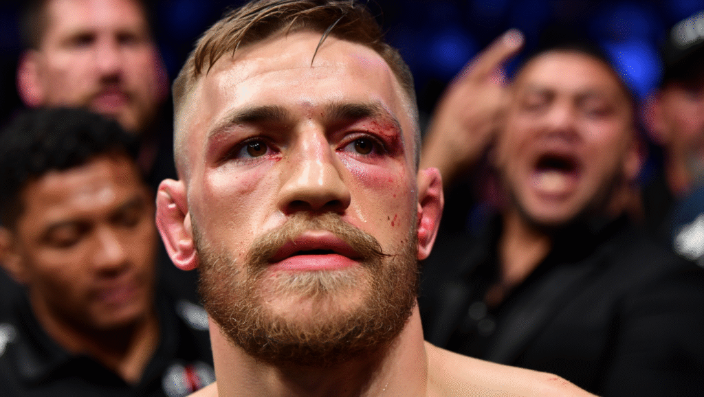 Conor McGregor dopo sconfitta UFC contro Nate Diaz - volto lividi sangue resilienza atleta business storytelling
